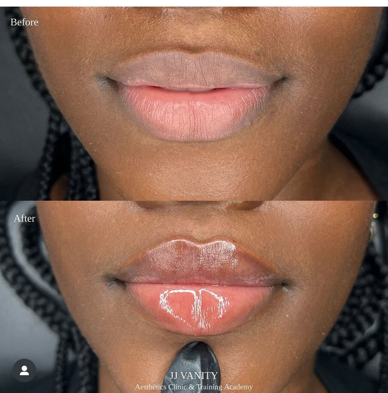 lips-1