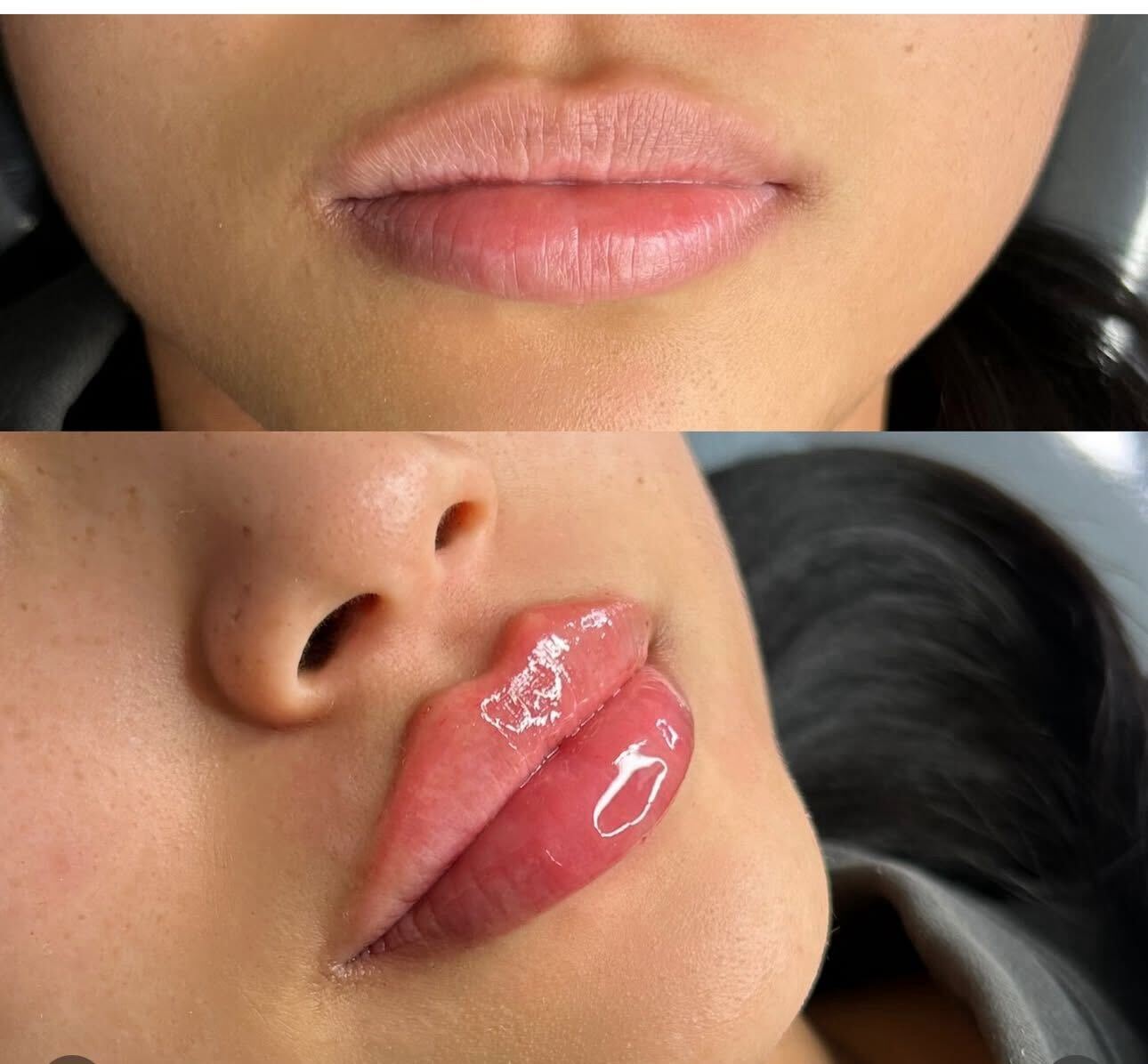 lips-2